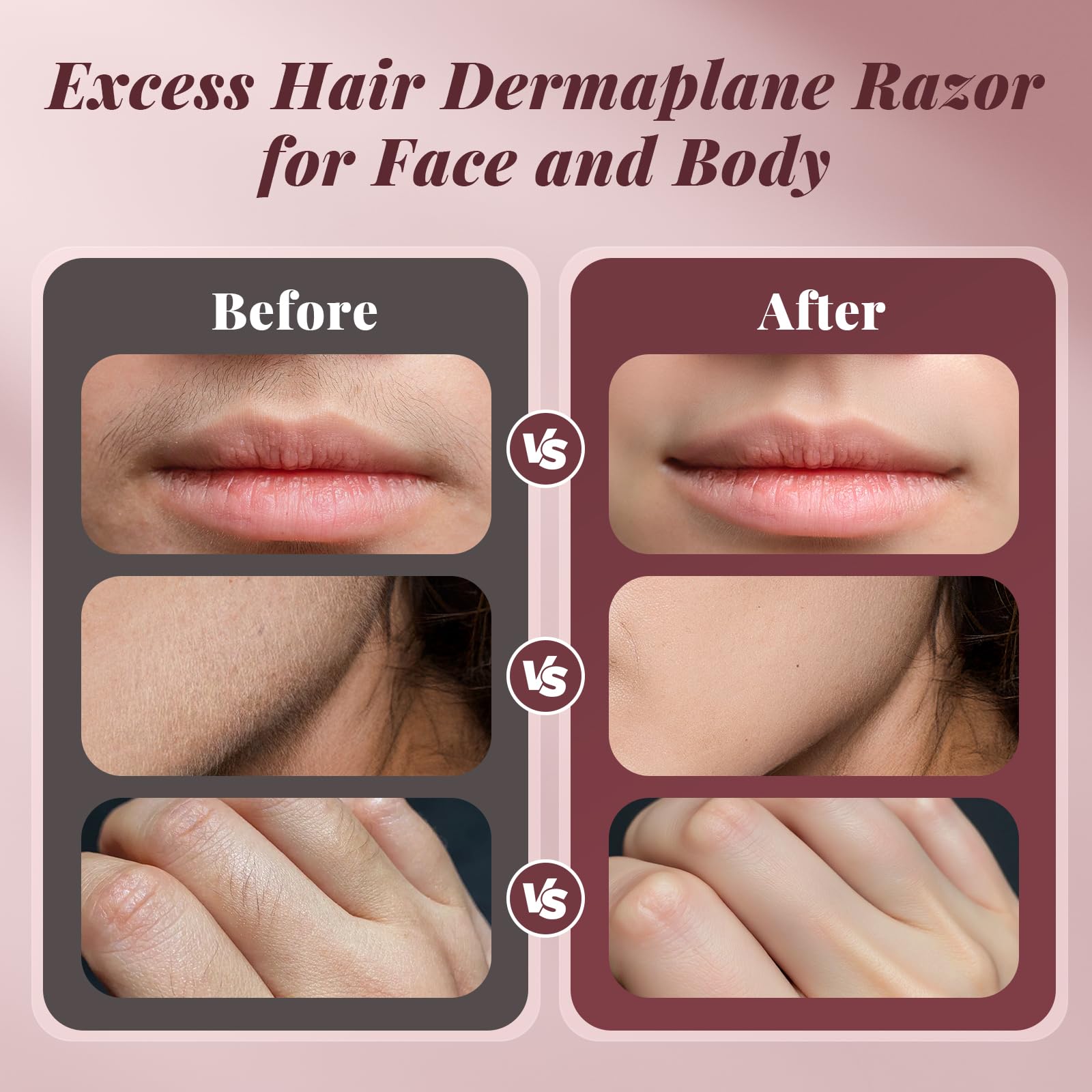 BNU at-home dermaplaning kit ready for travel use.