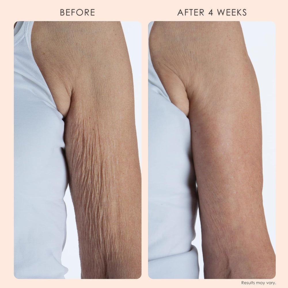 Body Firm Crepe Erase application on arm demonstrates smoothing daily ritual.