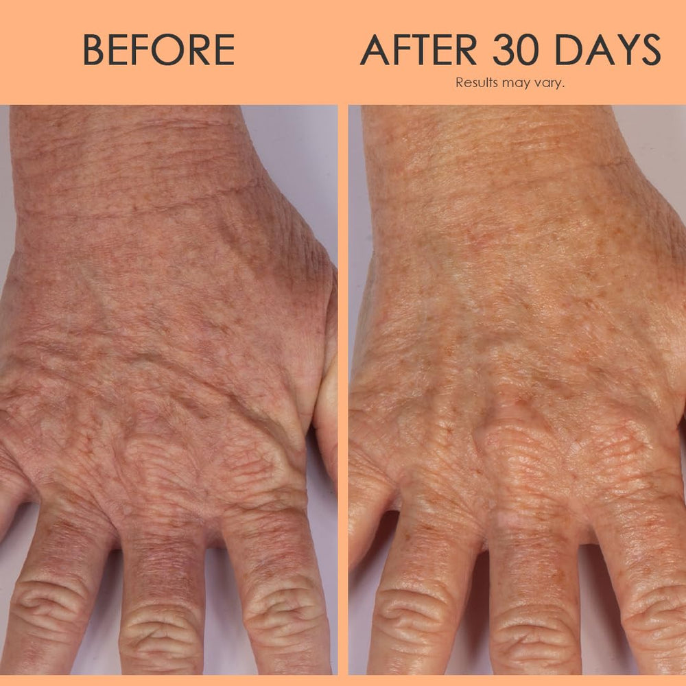 Body Firm Crepe Erase hands with cream showing smoother texture