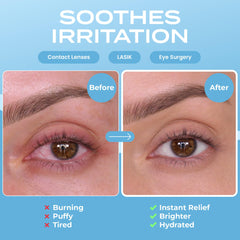 Body Restore aplicación de calor suave en ojos cansados