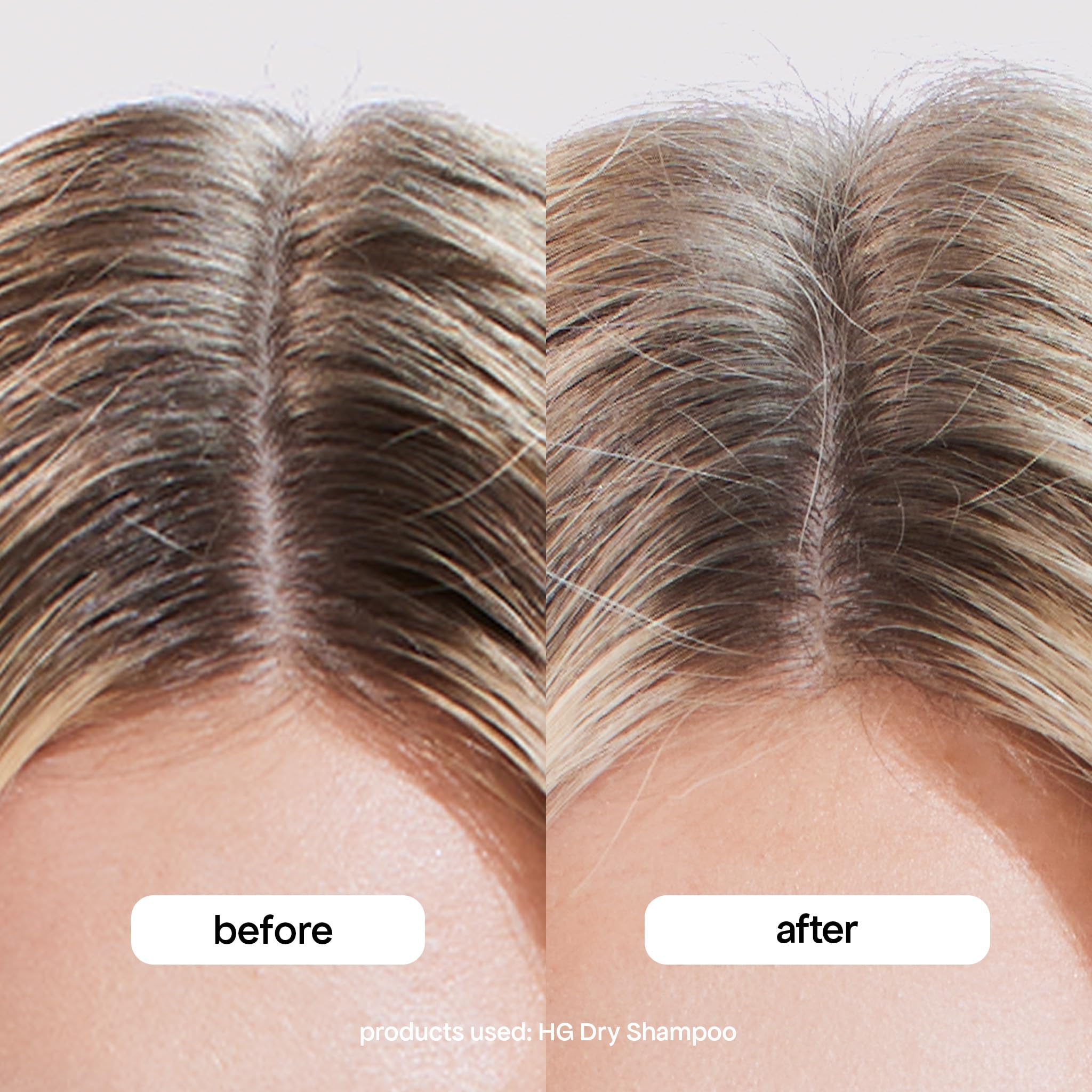 BondiBoost HG Dry Shampoo applied to roots for instant lift.