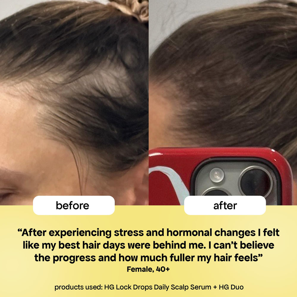 Daily routine with BondiBoost HG Lock Drops to support fuller-looking hair.