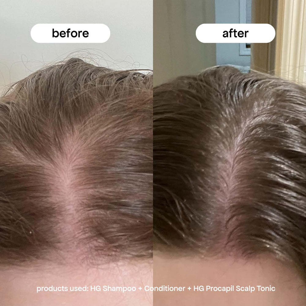 BondiBoost rosemary extract visual highlights natural botanicals supporting healthy scalp circulation.