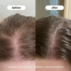 BondiBoost rosemary extract visual highlights natural botanicals supporting healthy scalp circulation.