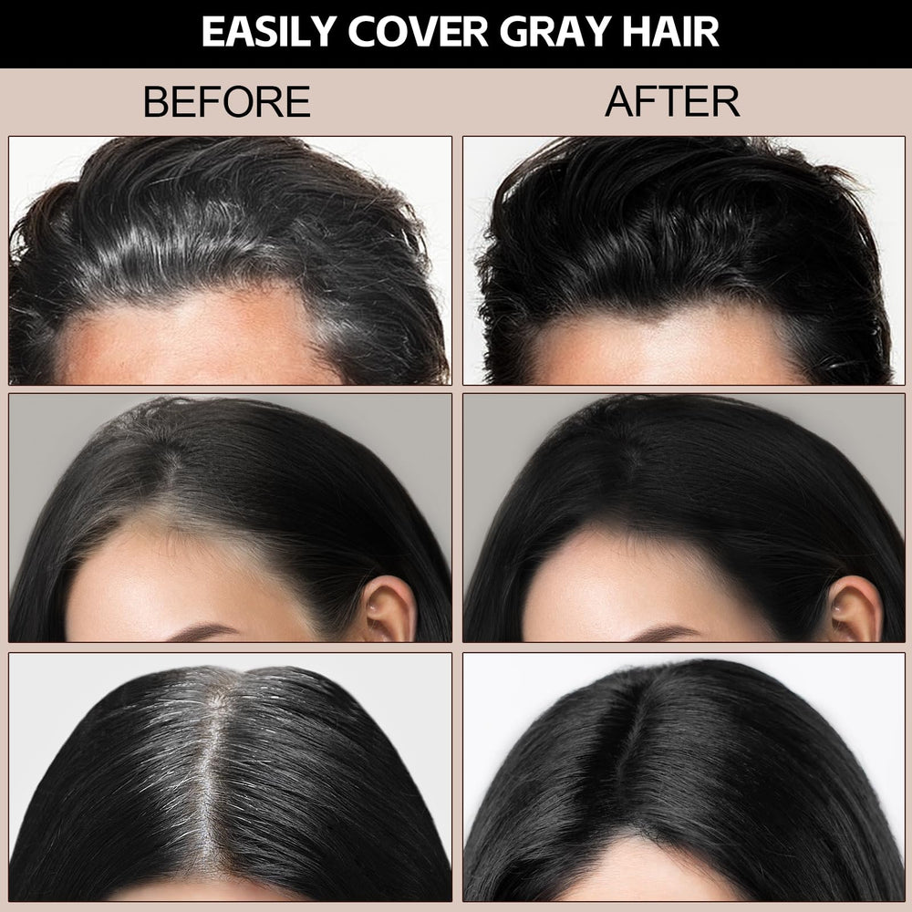 Boobeen root cover hairline demonstrating thinning edge concealment