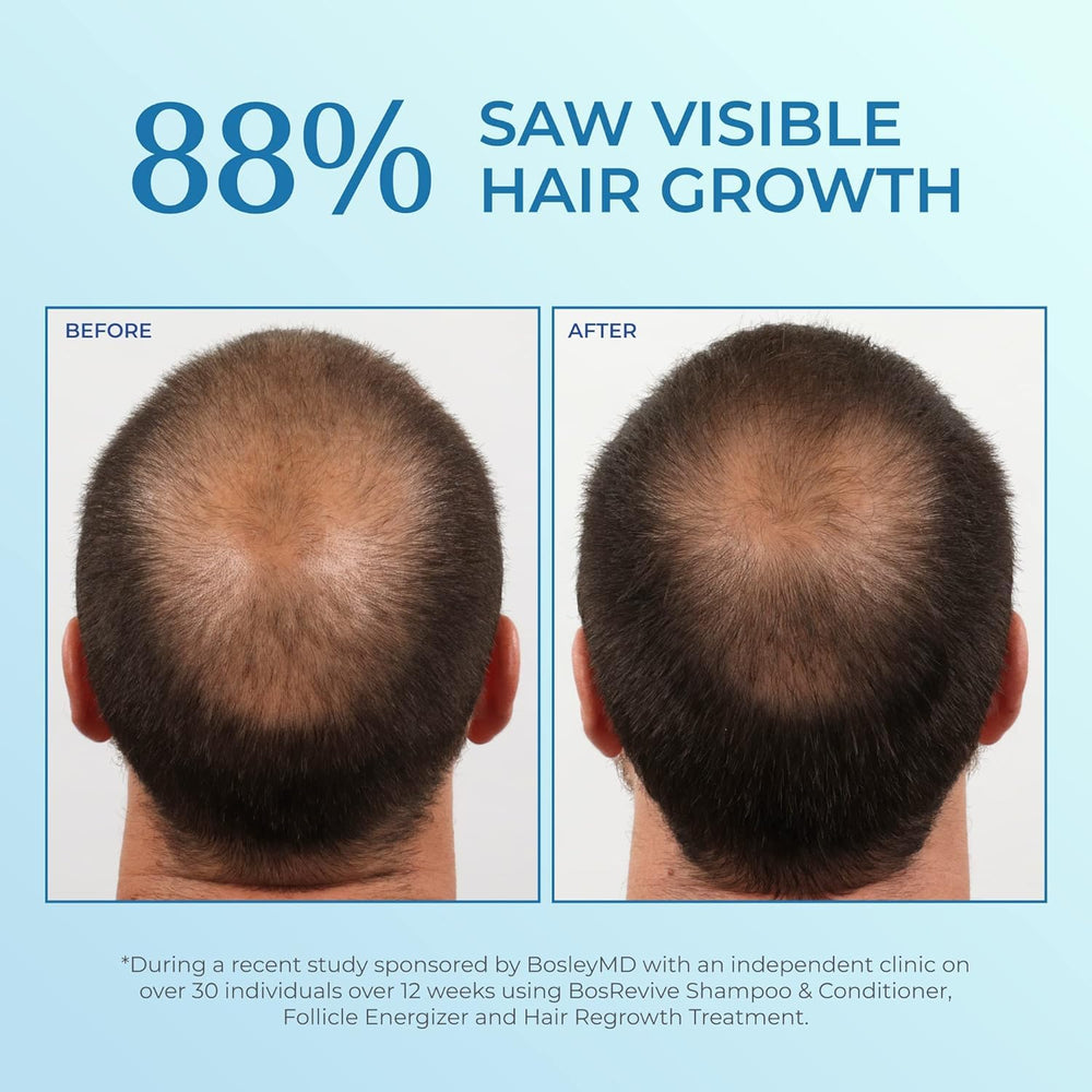 No-mess sprayer enables easy, convenient hair regrowth routine for men.