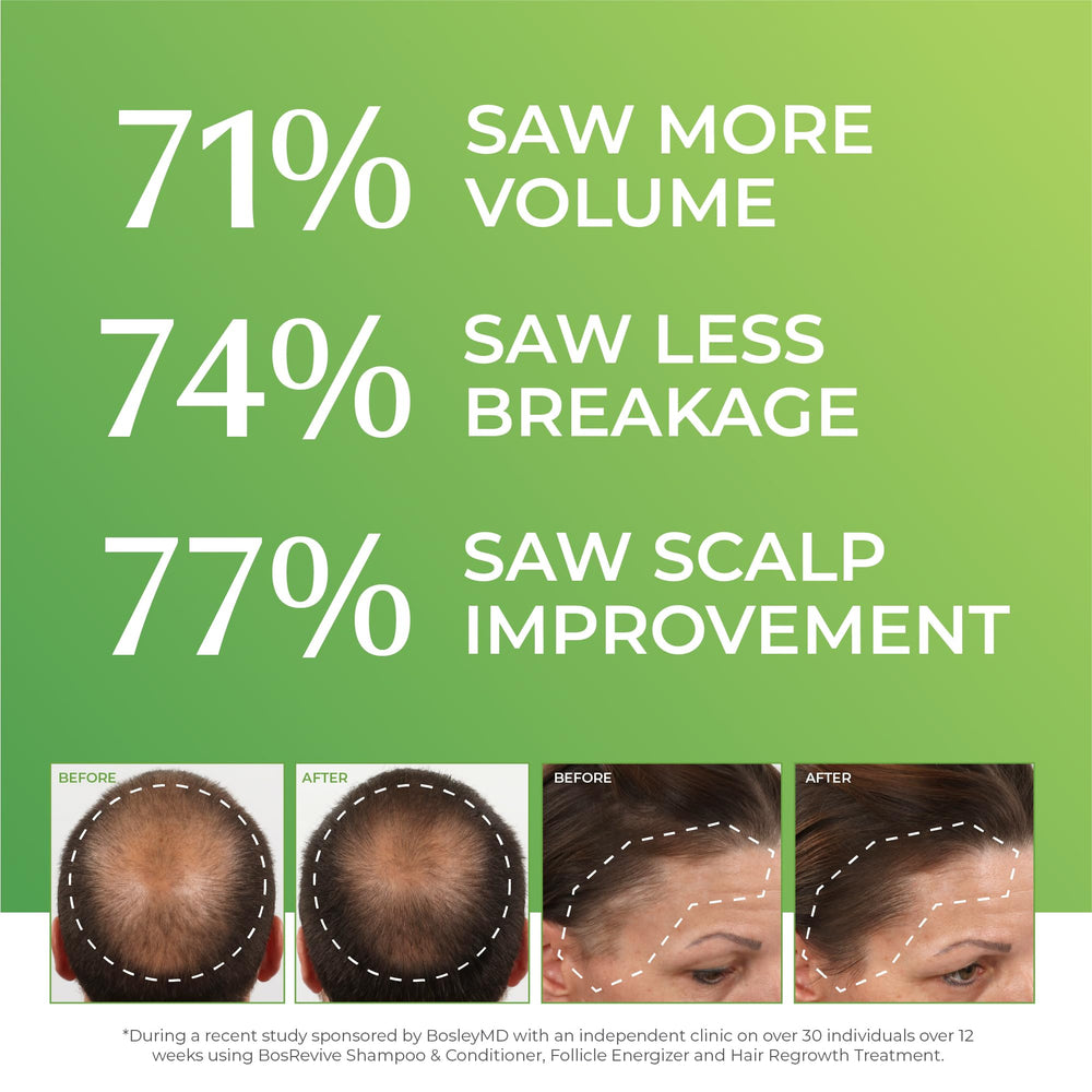 BosleyMD rosemary extract on hair scalp showcases anti-inflammatory support and improved microcirculation