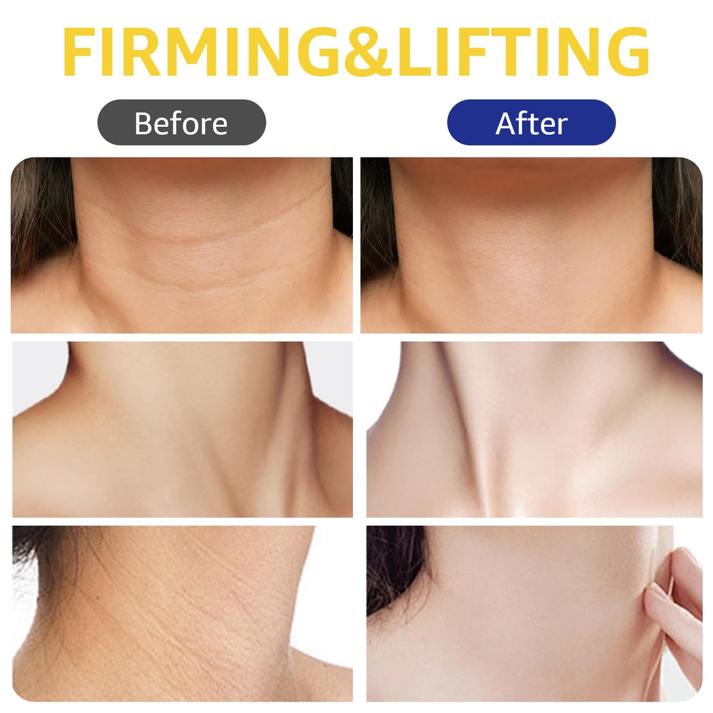 Botanikind Crema Cuello Contorno Definido para definición del contorno.