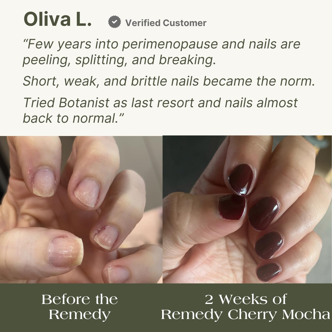 Kit completo de Botanist Nails El Remedio para manicura y fortalecimiento de uñas