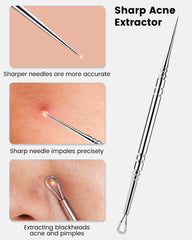 Boxoyx 420 stainless steel pimple extractor for durable use.