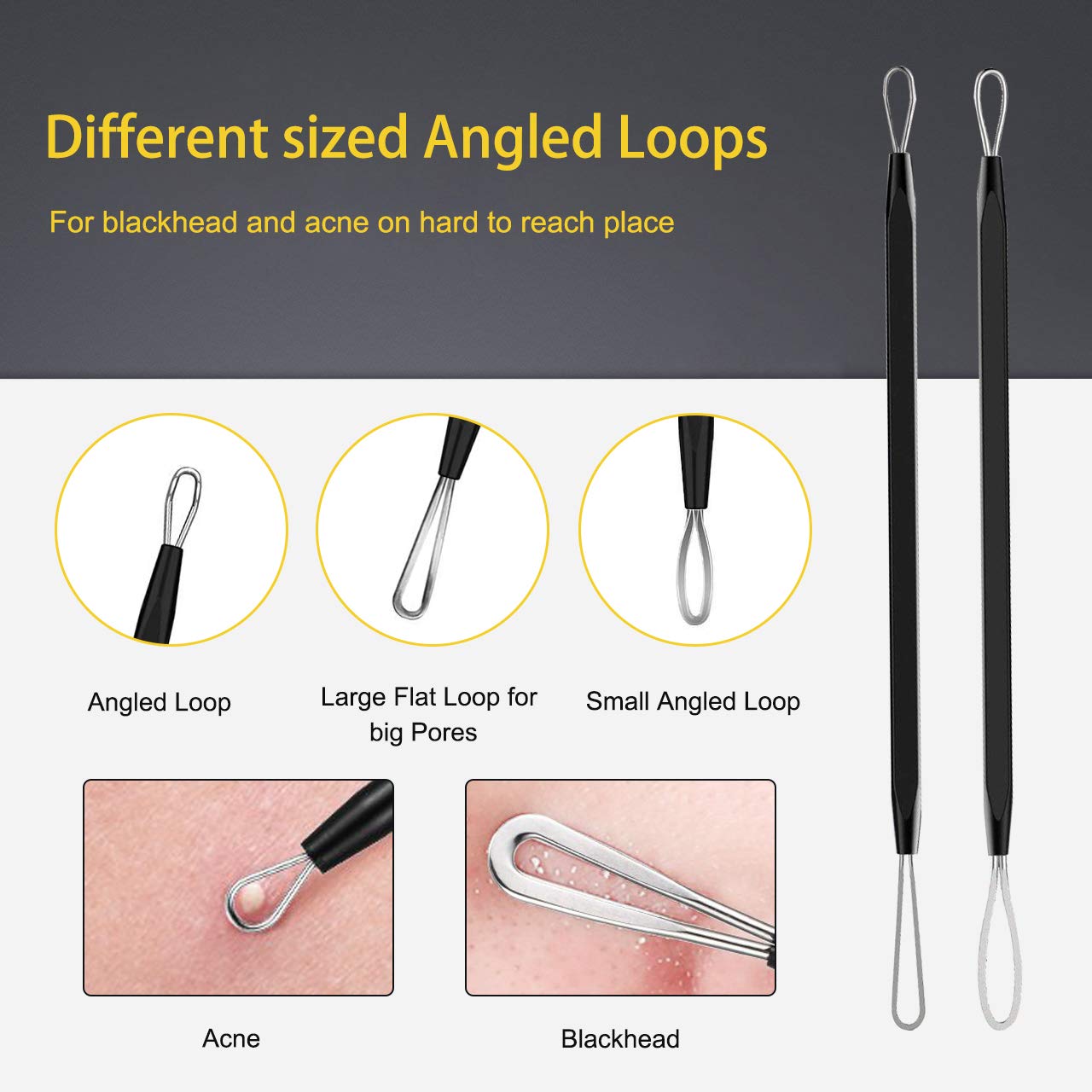 Boxoyx blackhead remover tools close-up showing stainless steel tips
