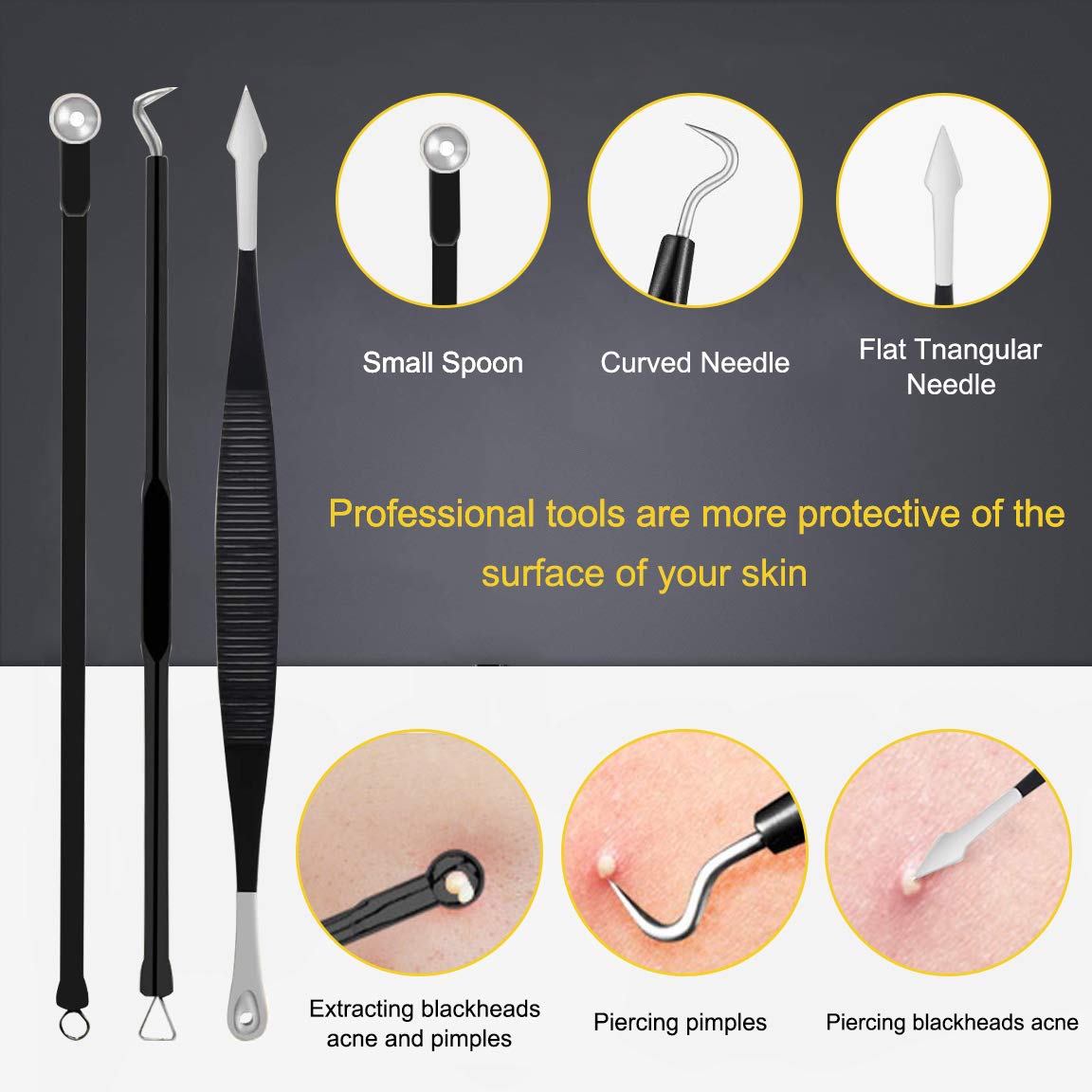 Boxoyx stainless steel pimple extractor for safe skin treatment
