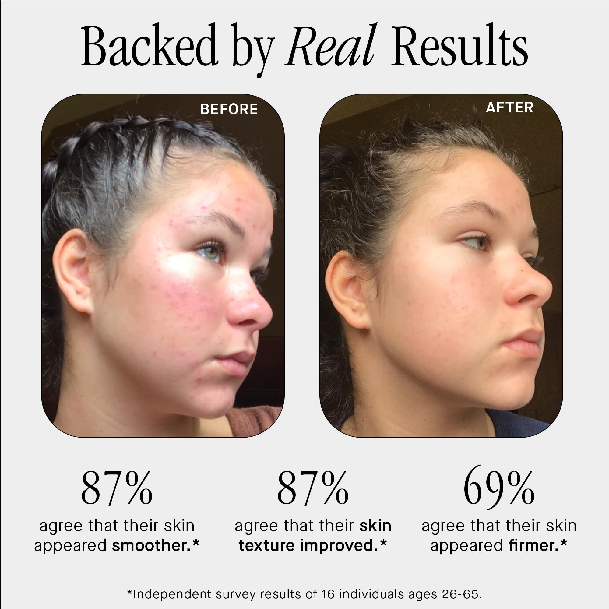 Brandefy No Needles serum texture close-up shows silky, non-sticky finish.