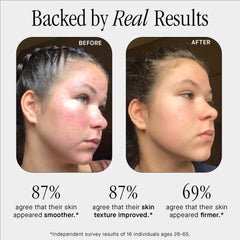 Brandefy No Needles serum texture close-up shows silky, non-sticky finish.