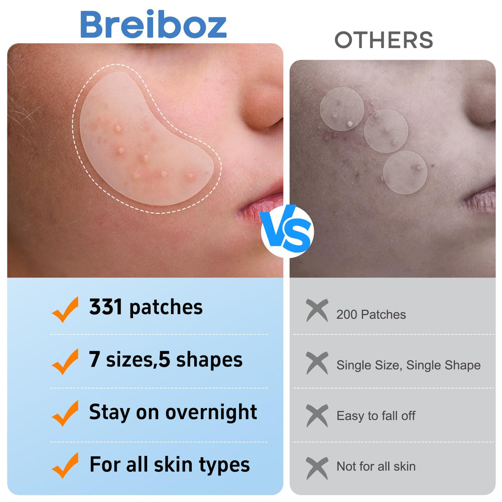Breiboz assorted sizes acne patches fit varied blemishes with precise coverage.