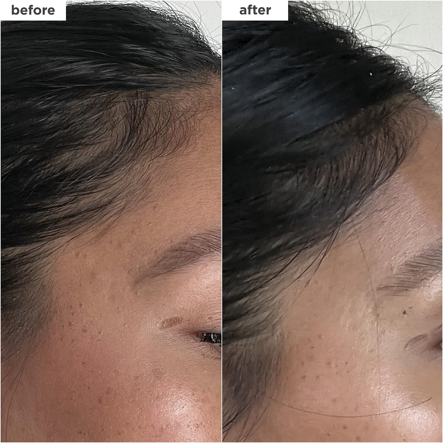 Briogeo Density Serum application dropper enables targeted scalp application.