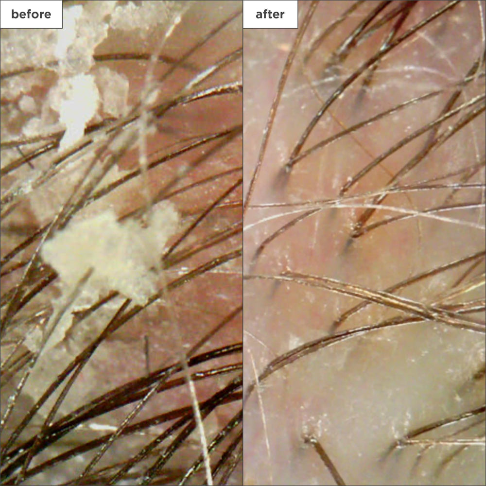Briogeo Scalp Revival, bisabolol y panthenol calman e hidratan el cuero cabelludo