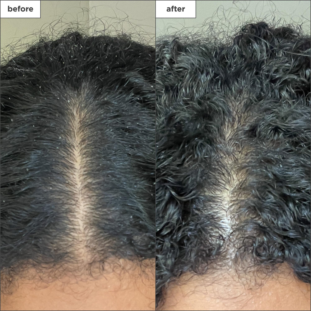 Briogeo Scalp Revival, complejo de menta para frescura y alivio