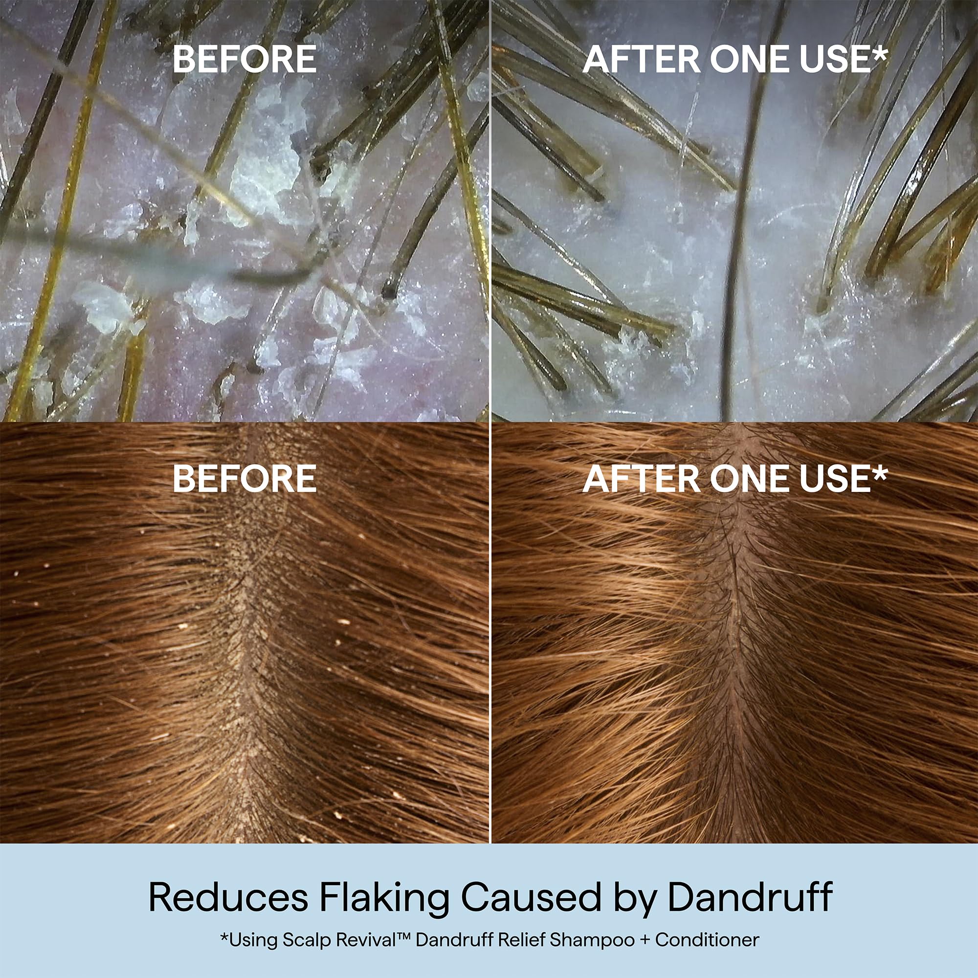 Briogeo 1.8% salicylic acid exfoliation shown on label for flakes support.