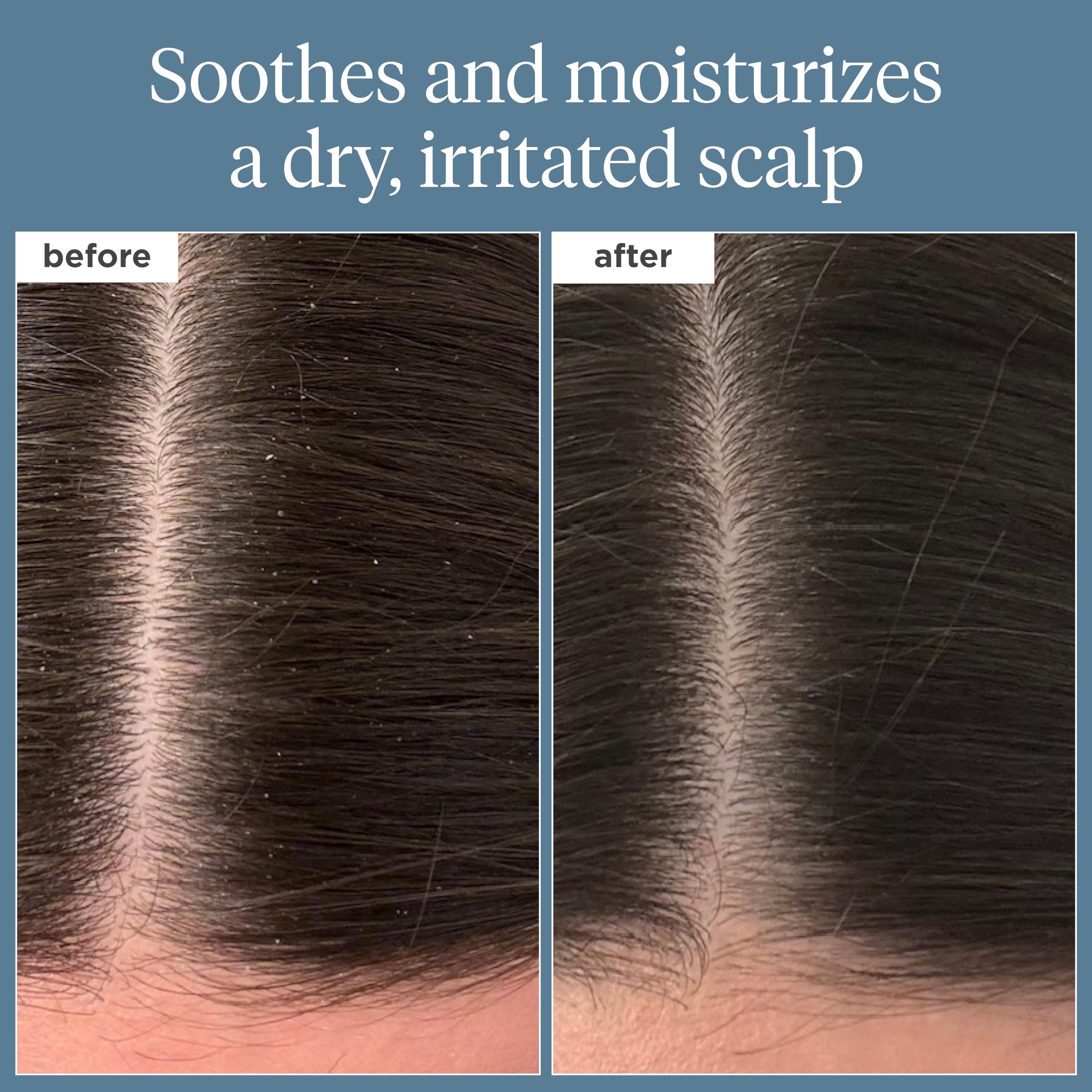 Briogeo Scalp Revival Rosemary Pre-Wash Oil pour closeup for easy scalp nourishment.