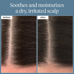 Briogeo Scalp Revival Rosemary Pre-Wash Oil pour closeup for easy scalp nourishment.