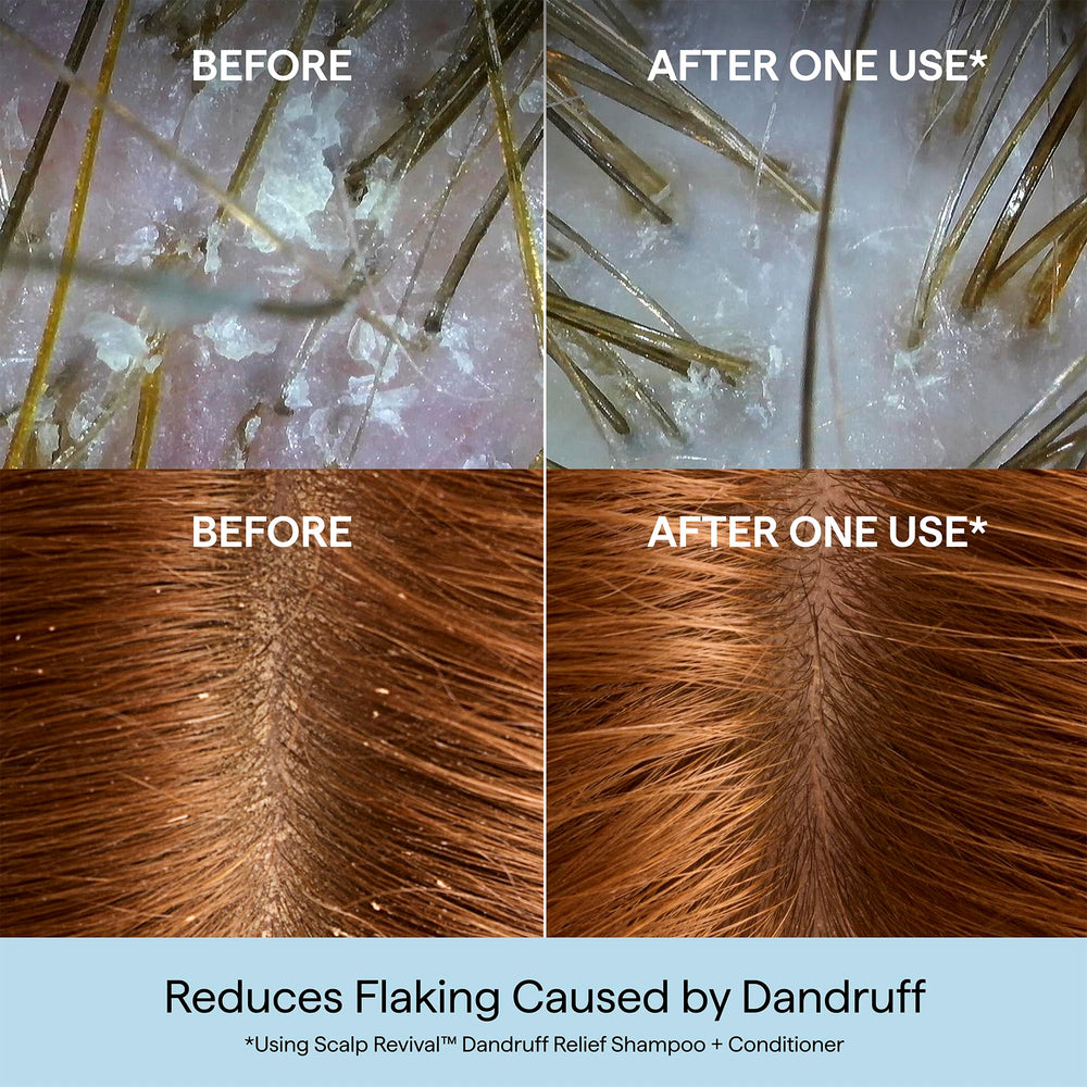 Briogeo Scalp Revival close-up shows charcoal and 3% salicylic acid for gentle exfoliation.