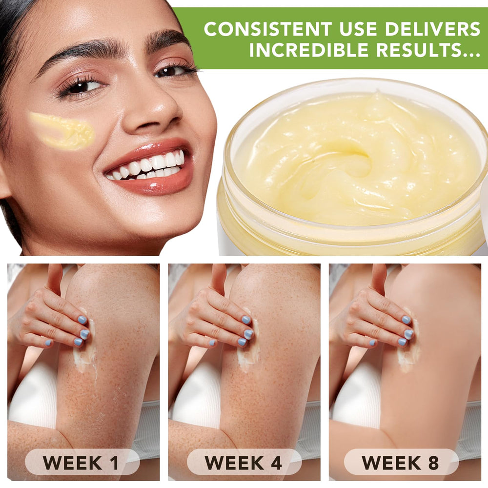 Btefls manteca de karité para cabello, ofrece brillo y cuero cabelludo saludable.
