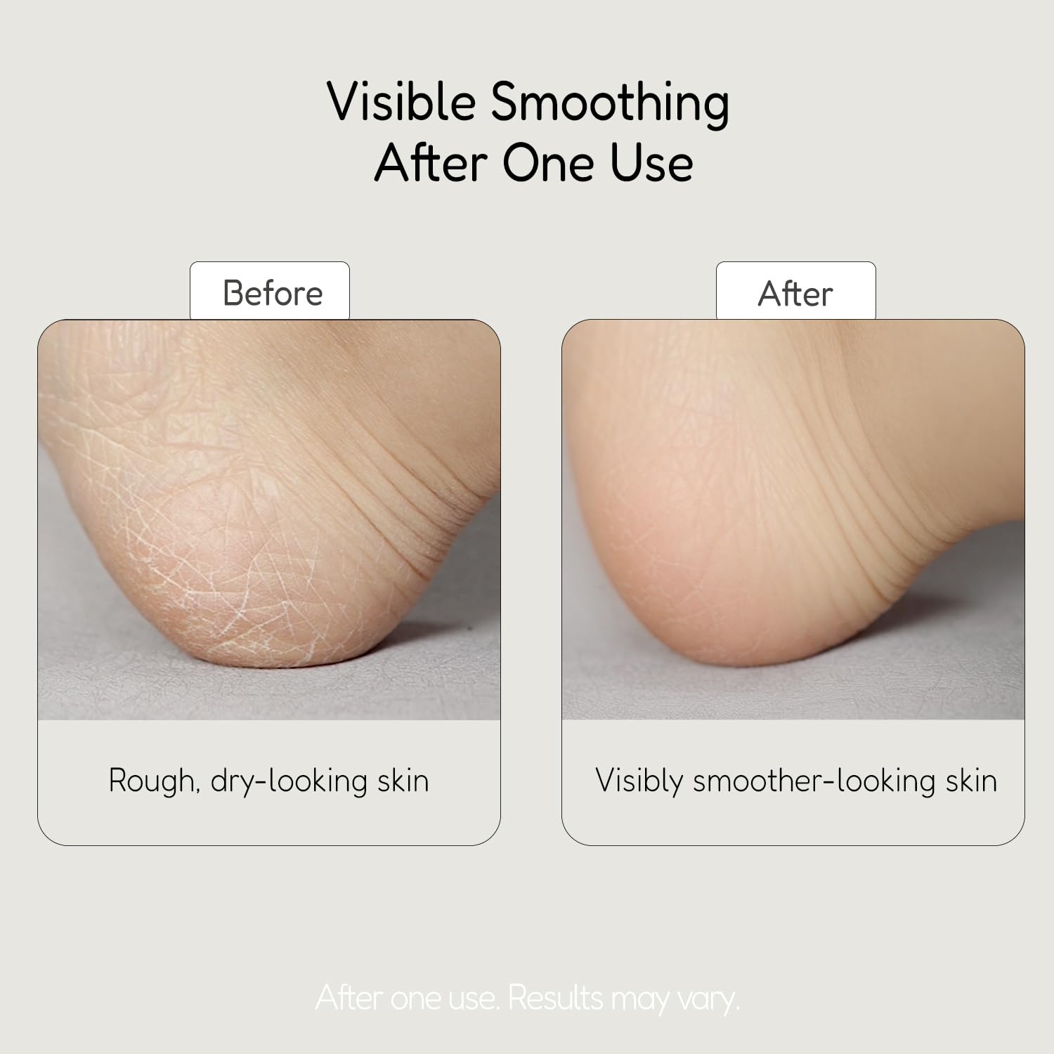 BuffOut exfoliante para codos y rodillas, piel más lisa.