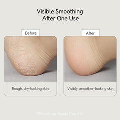 BuffOut exfoliante para codos y rodillas, piel más lisa.