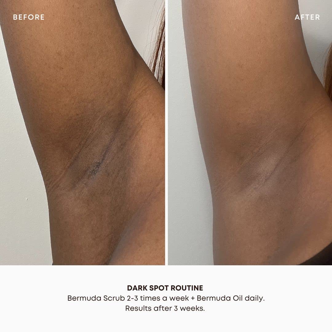 Bermuda Oil application on skin after scrub to support smoother pores.