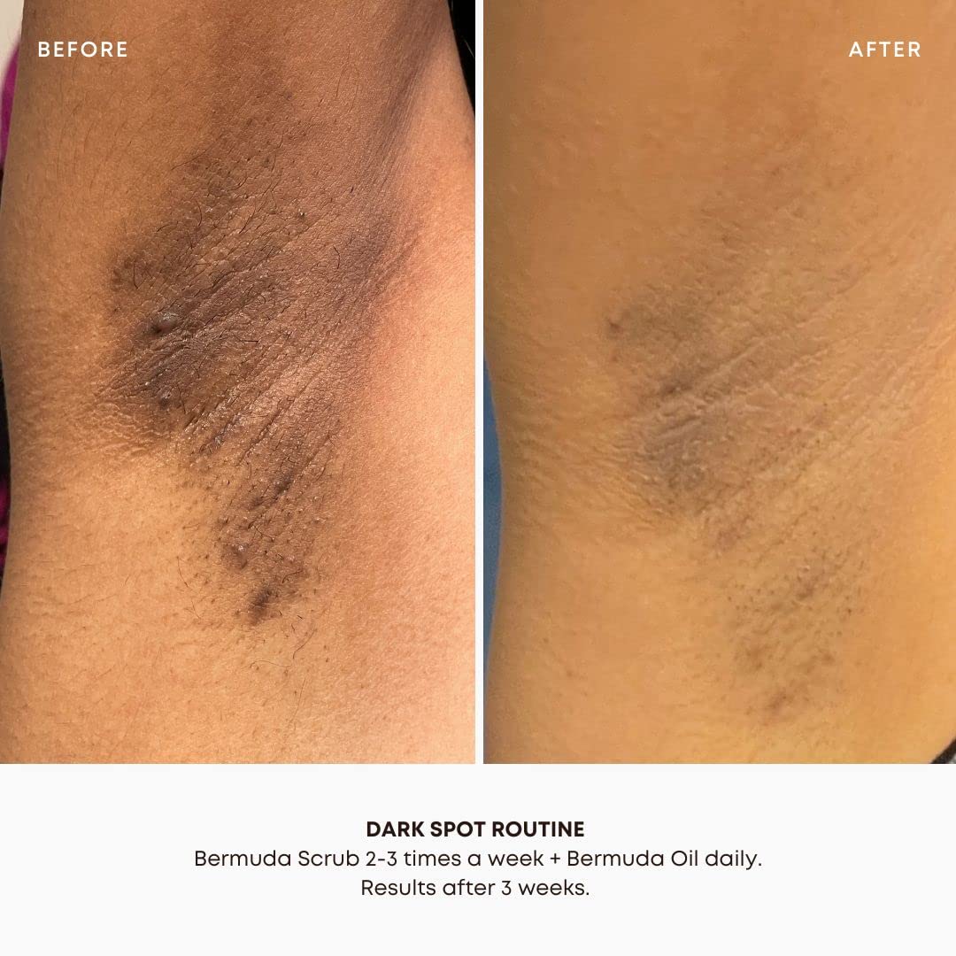 Bushbalm Bermuda two-step routine kit in-use scene.