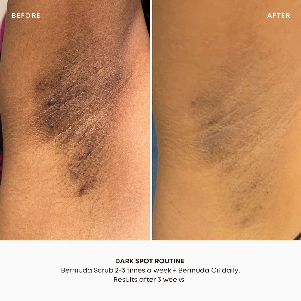 Bushbalm Bermuda two-step routine kit in-use scene.