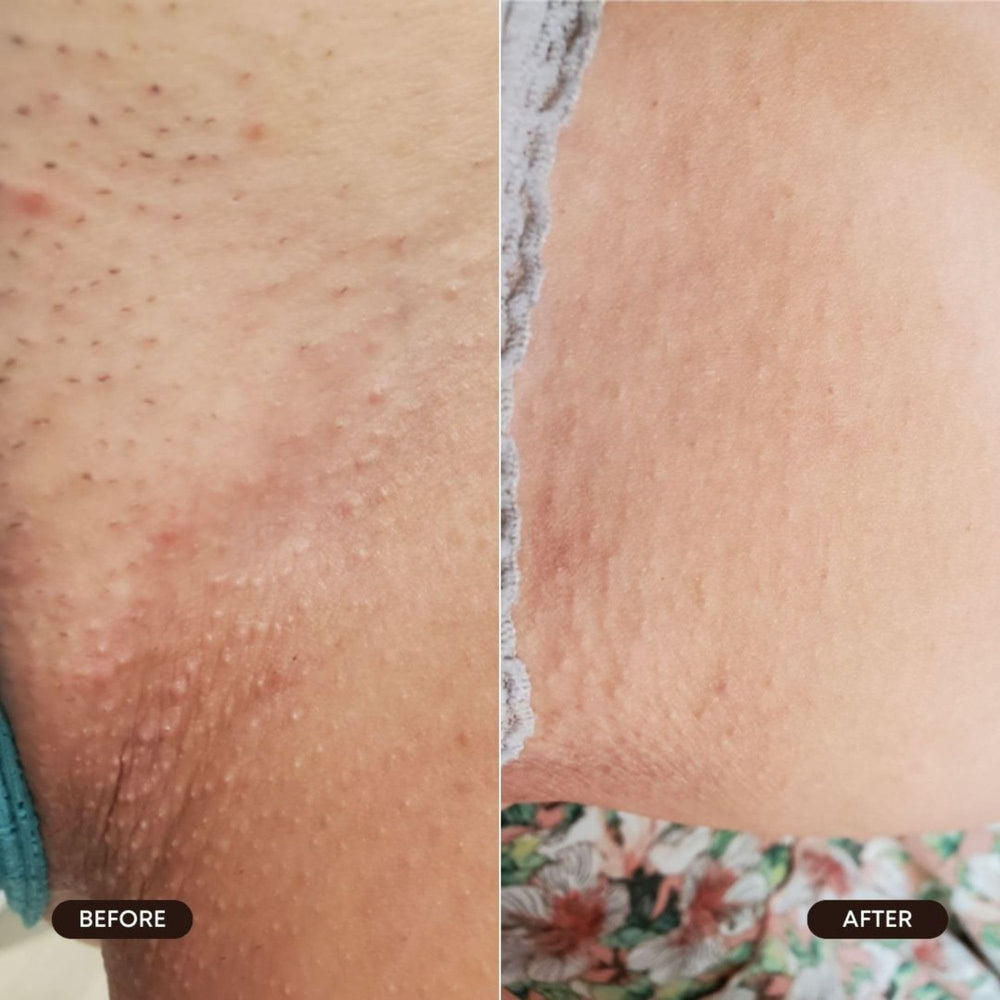 Bushbalm para axilas: reduce enrojecimiento y molestias posafeitado
