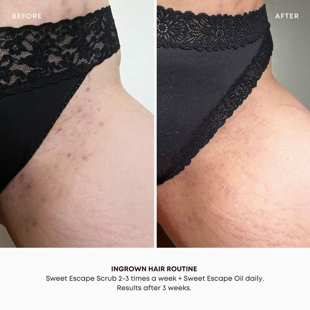 Scrub foam application demonstrates exfoliation and moisturizer prep