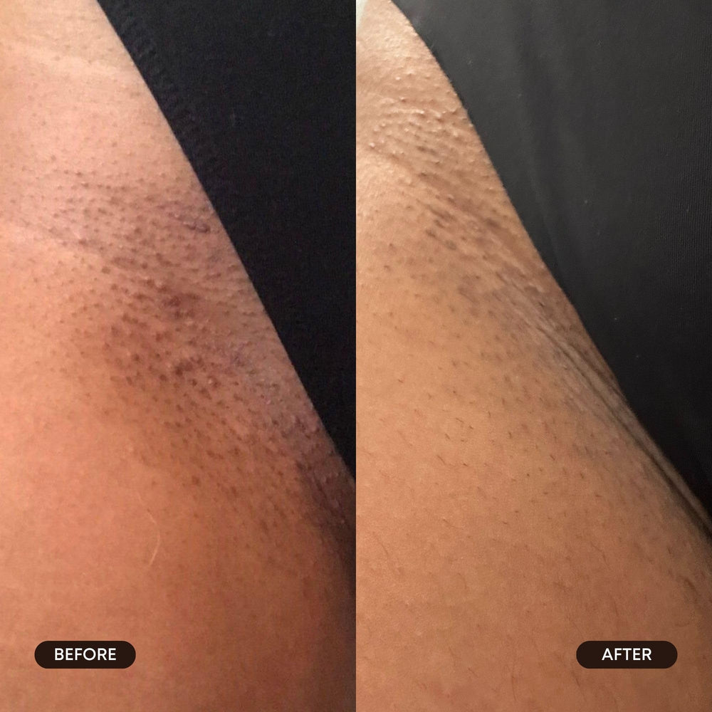 Tiras exfoliantes Bushbalm para uso diario en piel.