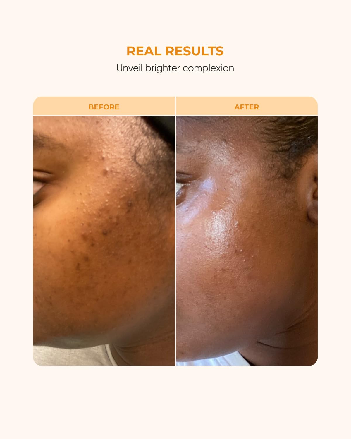 Buttah Skin Vitamin C Serum application close-up showing smooth absorption.