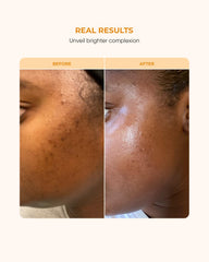 Buttah Skin Vitamin C Serum application close-up showing smooth absorption.