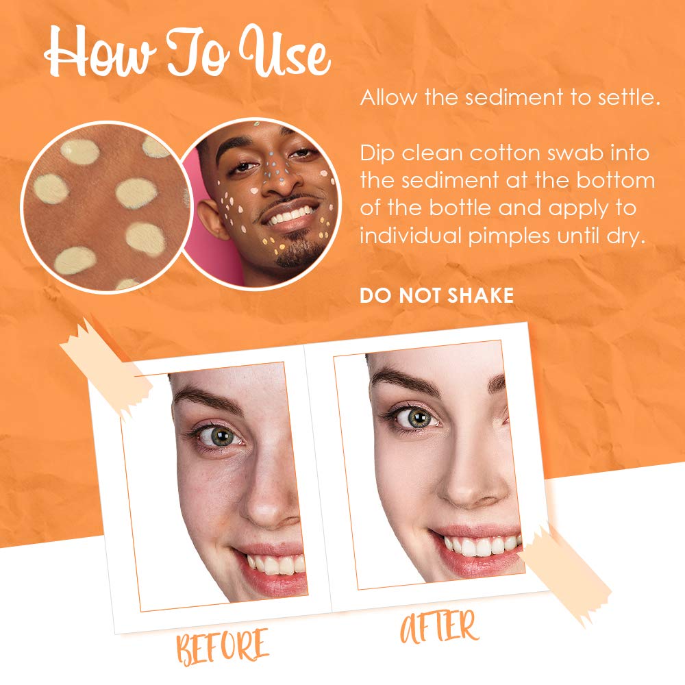 Bye Bye Blemish Lotion: brillo suave y uniforme que mejora la apariencia de la piel.