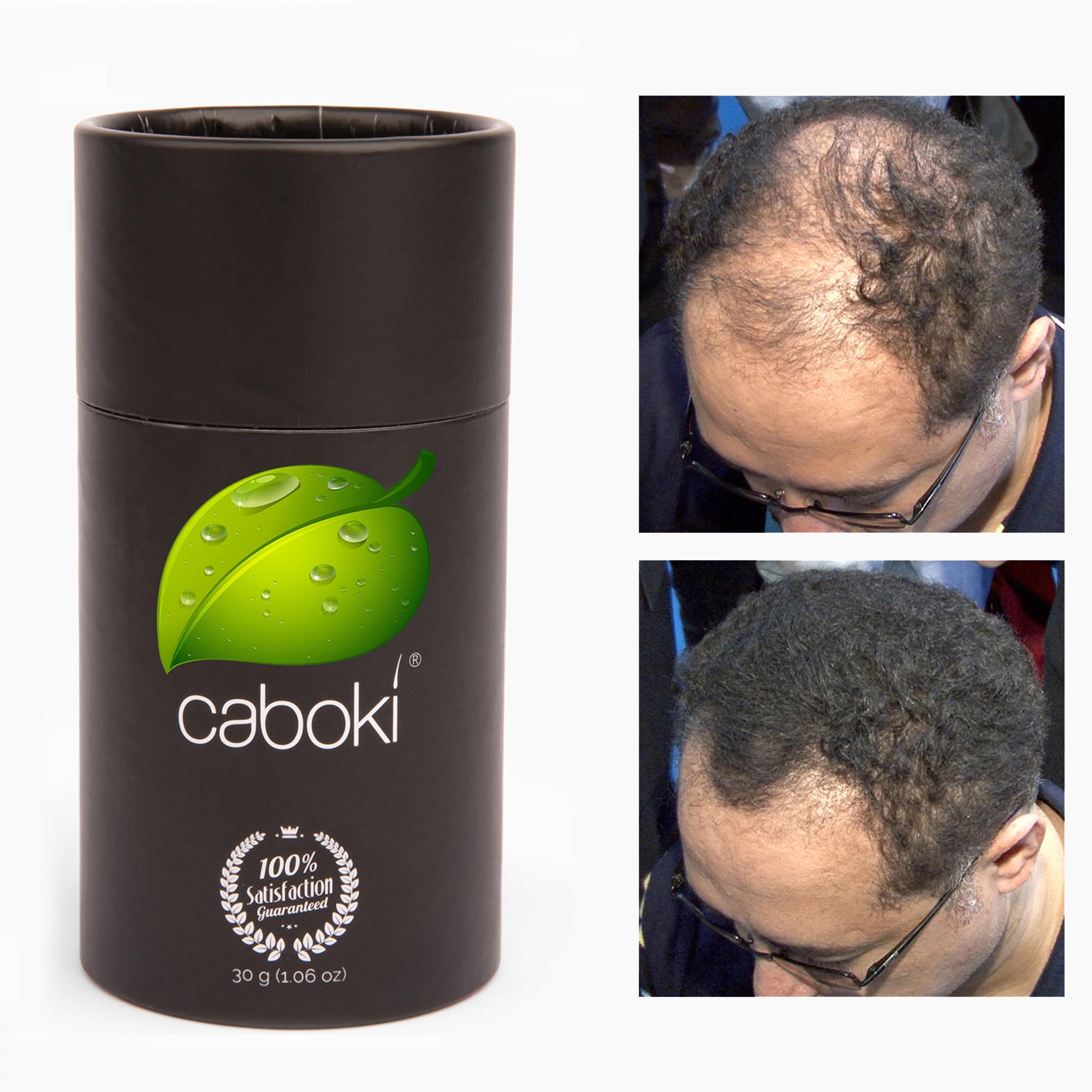 Caboki 90-day supply offering long-lasting value.