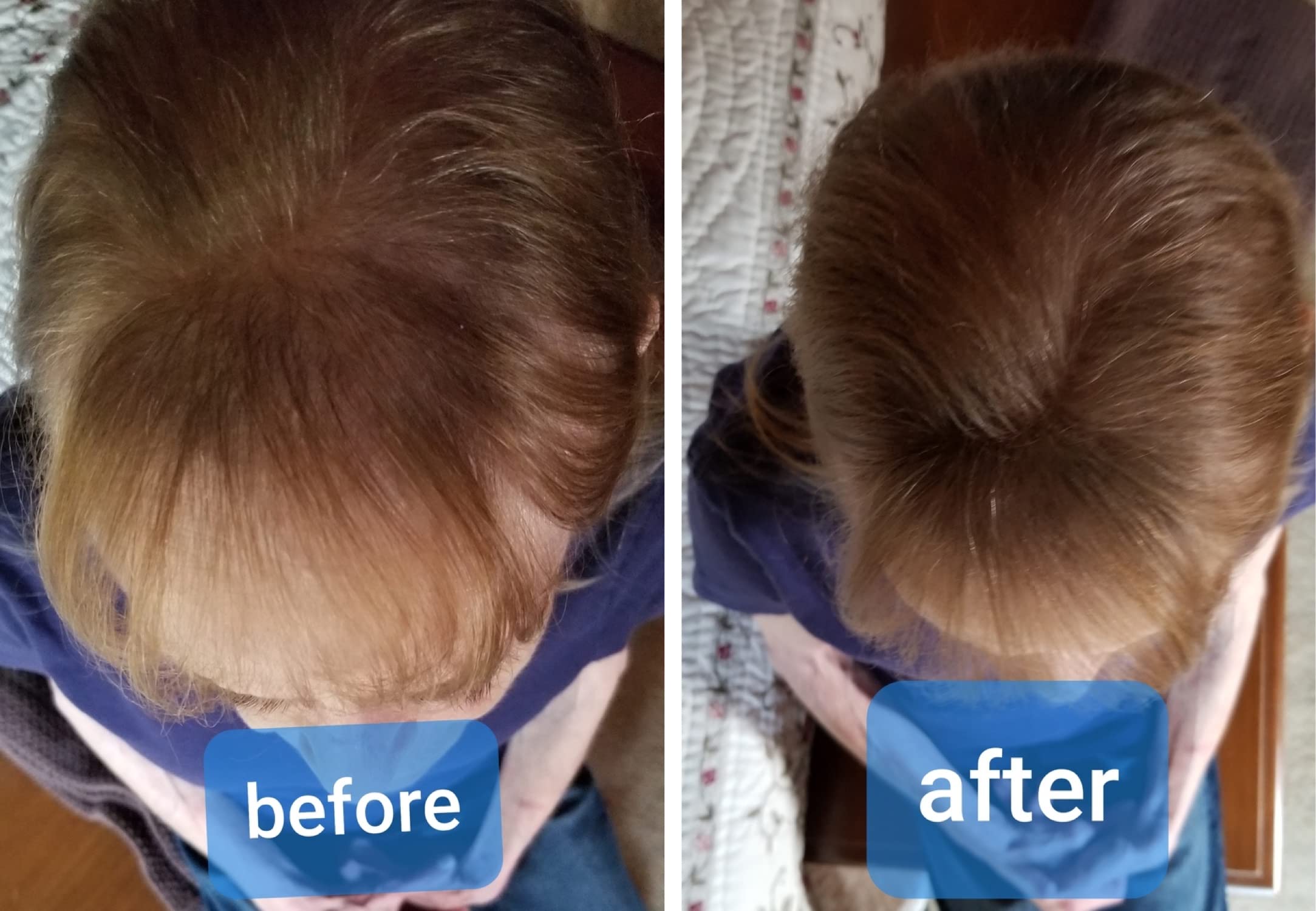 Shade range to match root color for natural blending