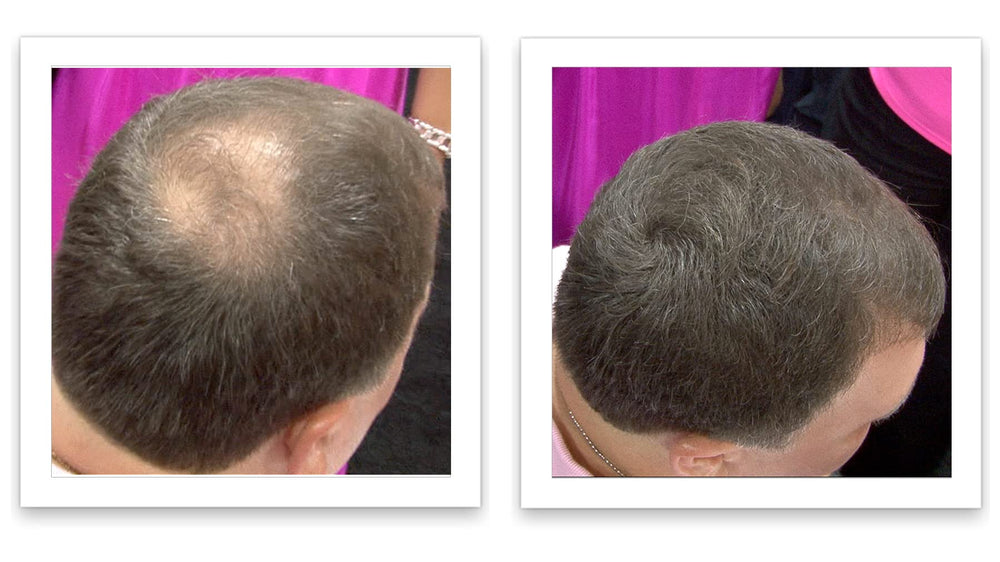 Easy shake-on application for quick coverage with Caboki