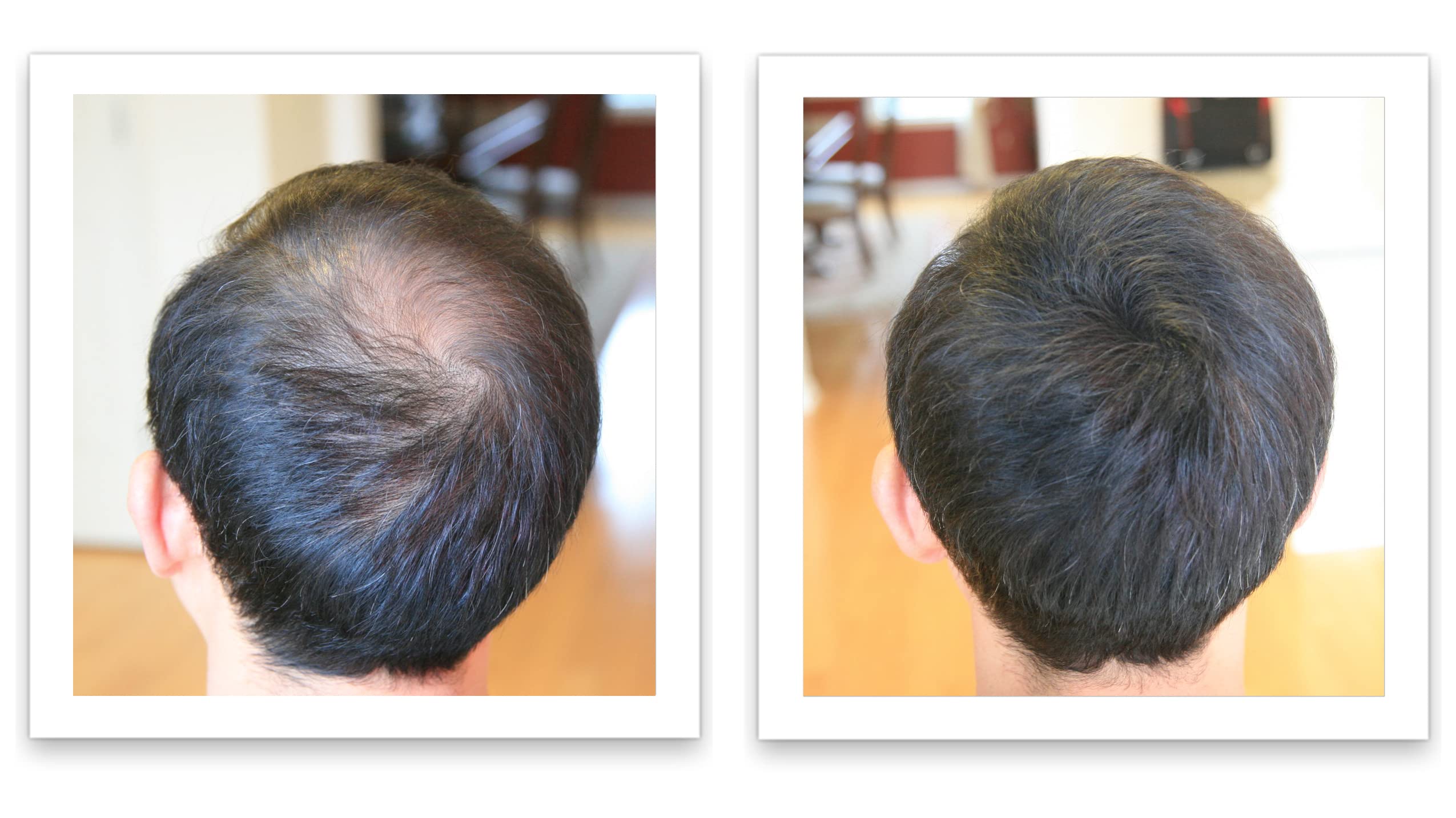Applying Caboki by shaking onto dry styled hair and patting distributes fibers.