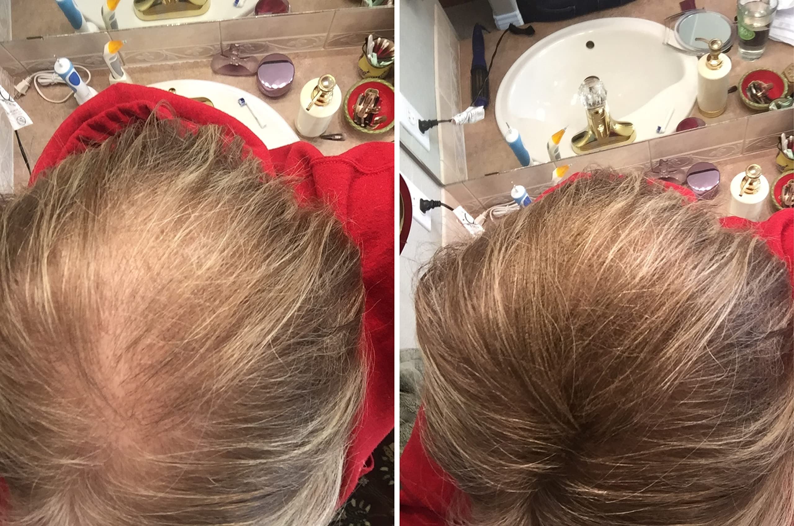 Caboki fibers blend with real hair for an undetectable finish.