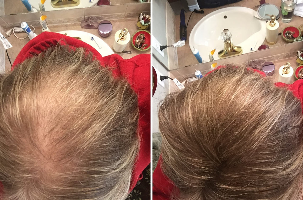 Caboki fibers blend with real hair for an undetectable finish.