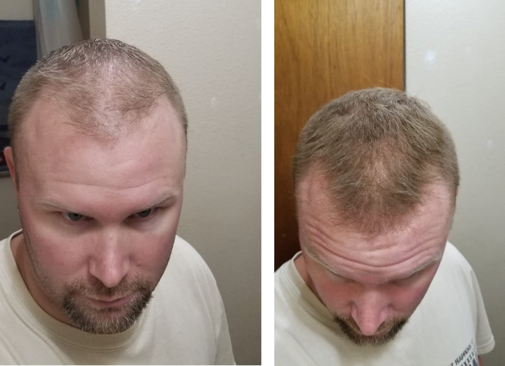 Multiple Caboki shades match root color for both genders.