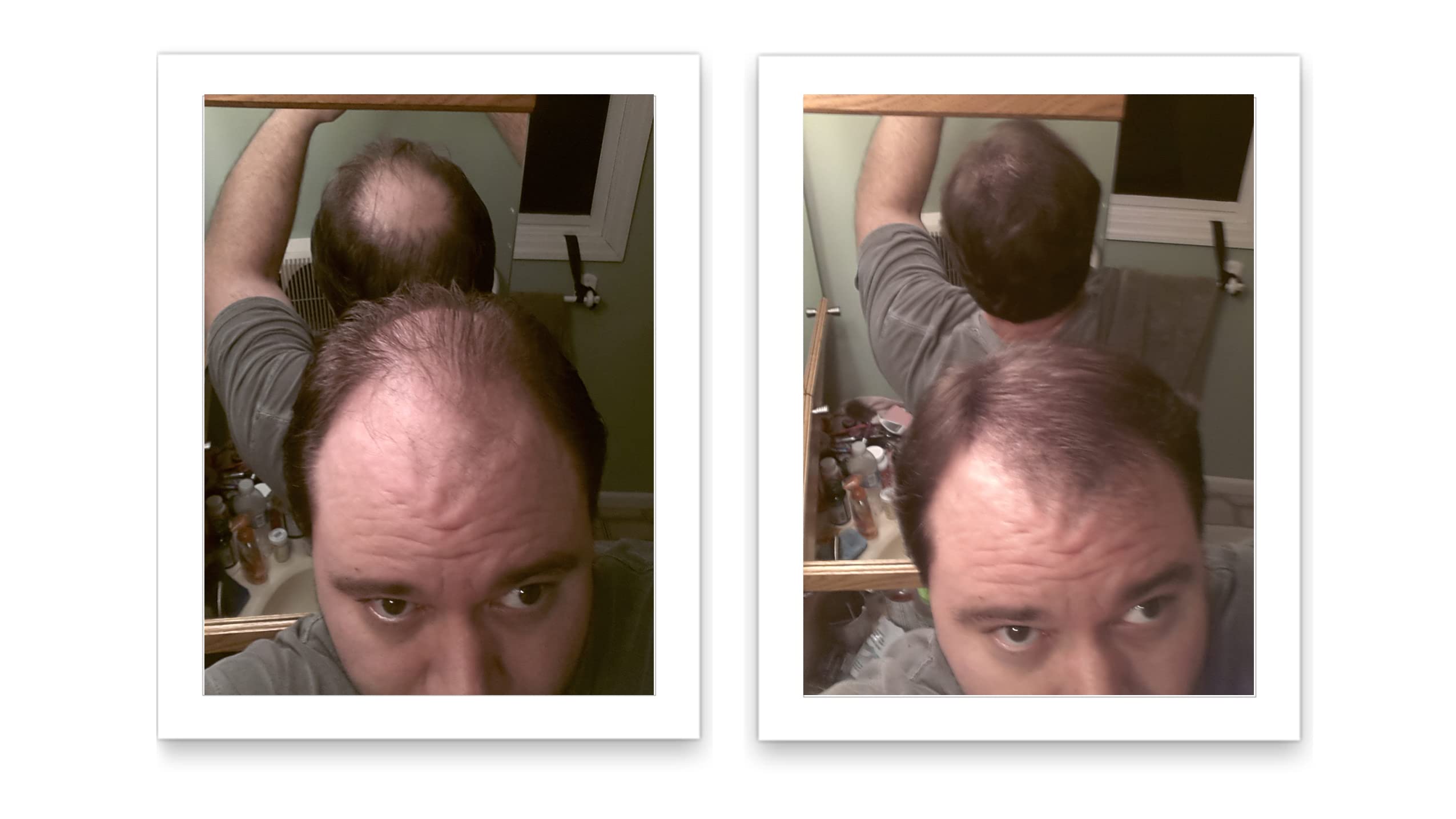 Close-up of textured hair with even natural-looking coverage using Caboki.