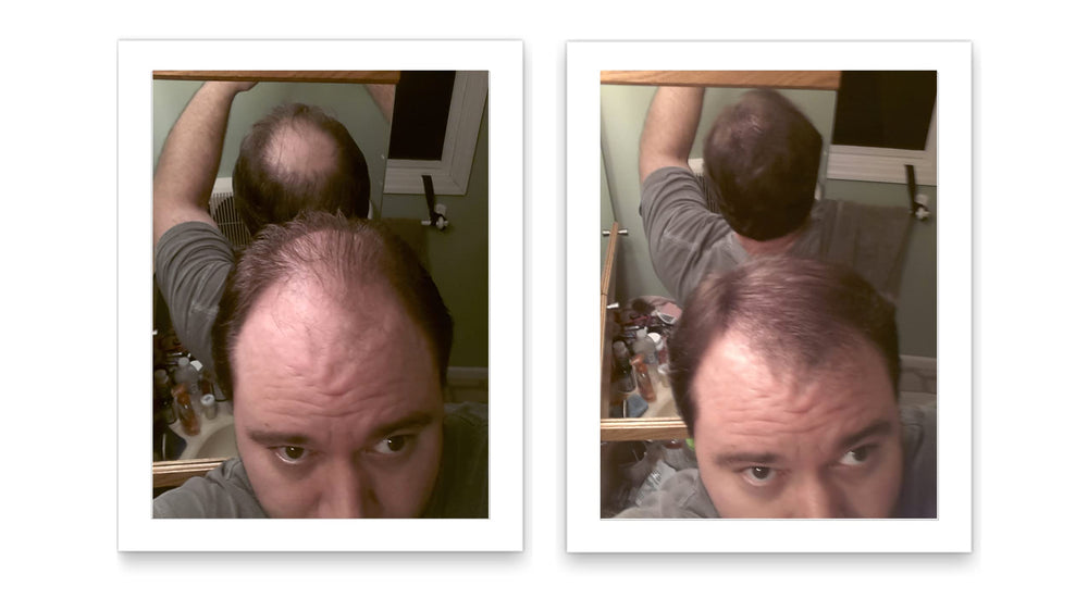 Close-up of textured hair with even natural-looking coverage using Caboki.
