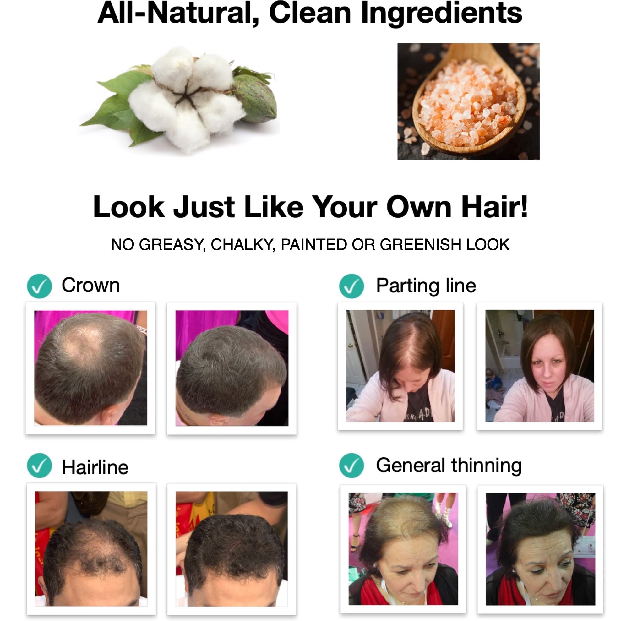 Caboki targets thinning crowns and receding hairlines for a fuller appearance.