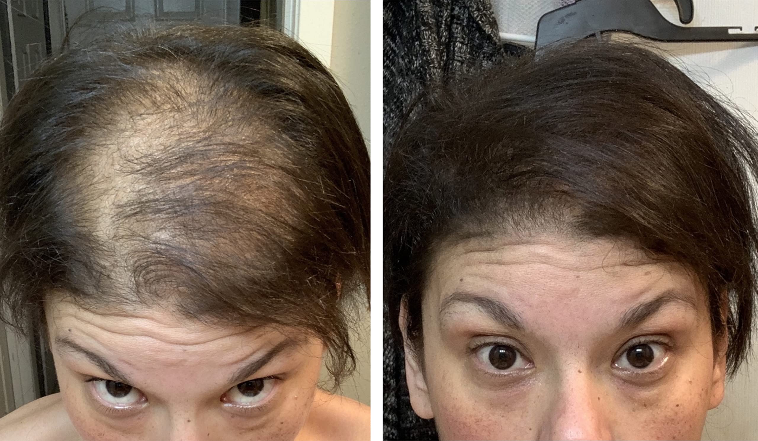 Caboki easy wash-out with shampoo after use.