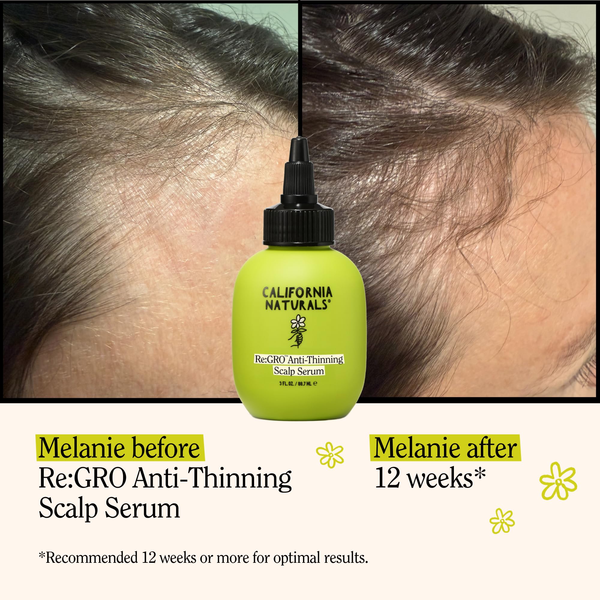 Re:GRO serum applied to the scalp for cooling, non-sticky feel.